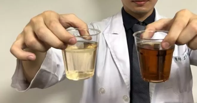 泰國旅遊開心吃海鮮 回國竟尿出「紅茶」