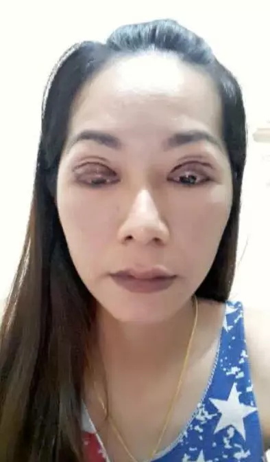 整形50次!「喪屍裘莉」本尊素顏照曝光 網驚:鄰家女孩