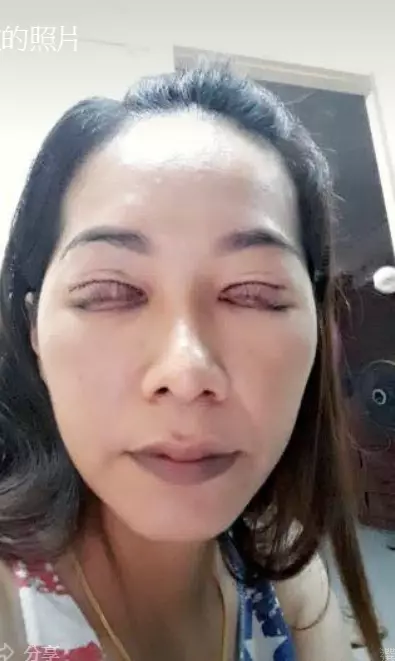 整形50次!「喪屍裘莉」本尊素顏照曝光 網驚:鄰家女孩