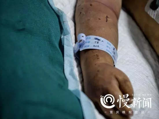 男童疑遭奶奶長期毒打 母親:婆媳關系不和遷怒孩子