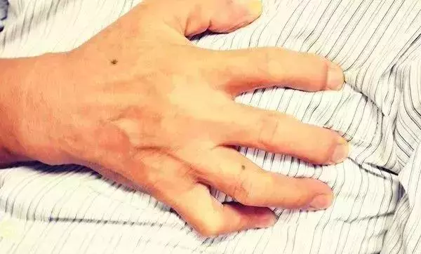 健康|睡姿能反應身體問題!10種疾病各有專屬睡姿……你是哪種?