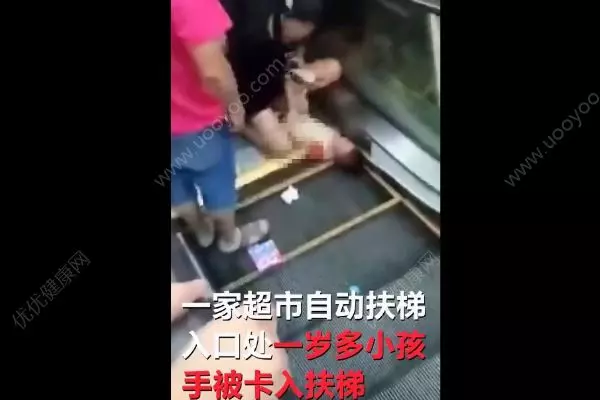 母親忙刷手機,兒子遭捲入手扶梯!手臂幾乎完全斷離!【內有視頻】