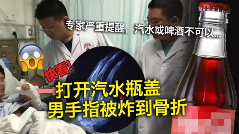 打開汽水瓶蓋 男手指被炸到骨折