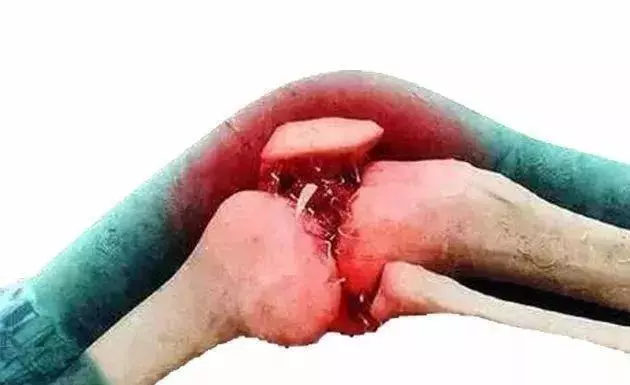 關節炎?走路痛?洋蔥這樣用,「趕」走膝蓋痛!快學起來~