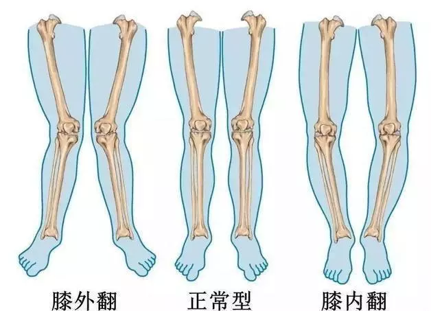 關節炎?走路痛?洋蔥這樣用,「趕」走膝蓋痛!快學起來~