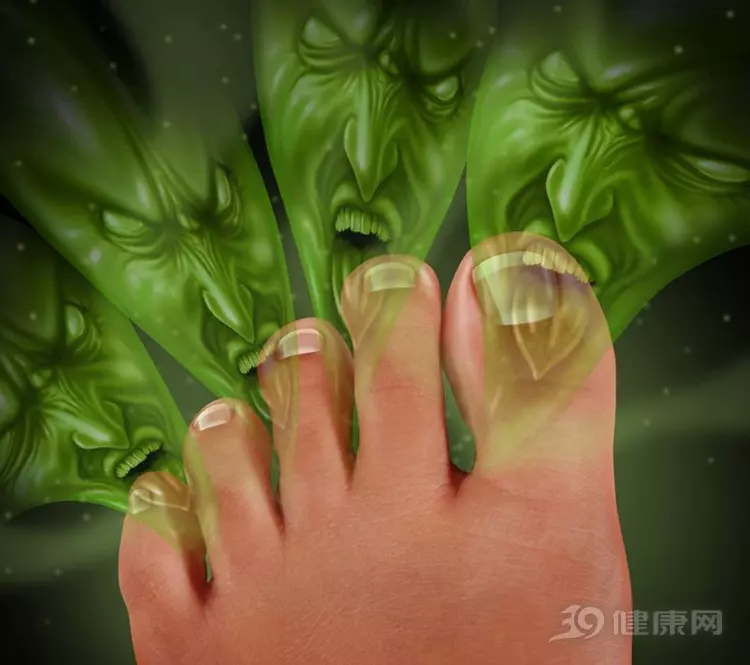 腳臭招人煩,怎麼辦?送你4個絕招,後悔才知道!
