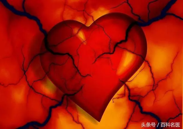 6大因素易導致腦血管病發病!