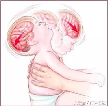 孩子被搖成腦癱?別再這樣晃孩子!