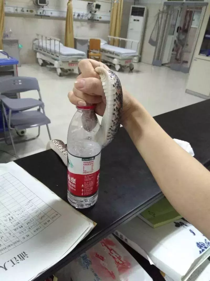 強!女子被咬傷,捉著活蛇淡定求醫!!