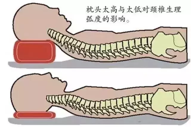 枕頭用錯了傷頸椎,你可能一直沒枕對!