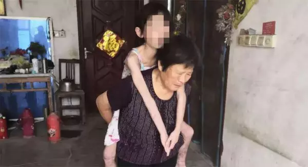 少女患罕病 皮膚奇癢難耐