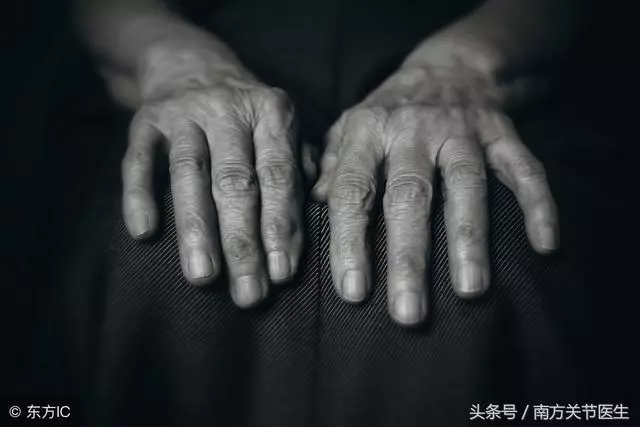 預防「滑鼠手」應該怎麼做?做好這5點事半功倍