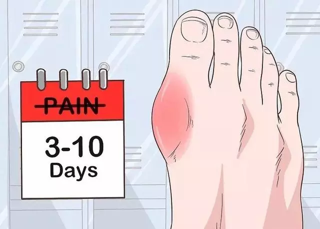 身體這3個表現,說明尿酸已經高的可怕!做到「三多四少」降尿酸