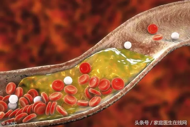 血管幹凈人長壽!7種便宜食物能掃清血管垃圾,再也不怕血管堵塞