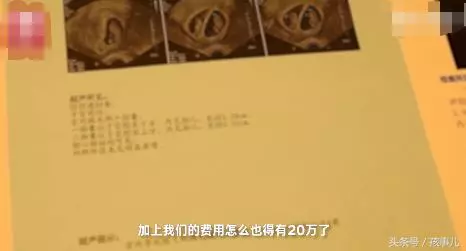 67歲失獨母親懷上雙胞胎:醫院封殺我 要個孩子咋就這麼難?