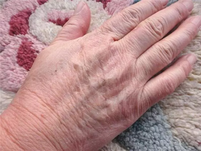 女人操持家務雙手粗糙又乾裂很難勘?教你一個小法子,小手變的白嫩光滑更好看