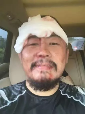 「格鬥狂人」挑戰小鮮肉 遭飛膝踢爆眉骨