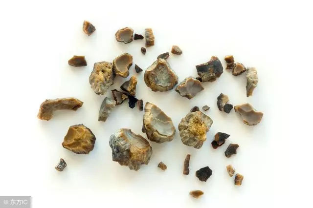 真正會得結石的食物是這些