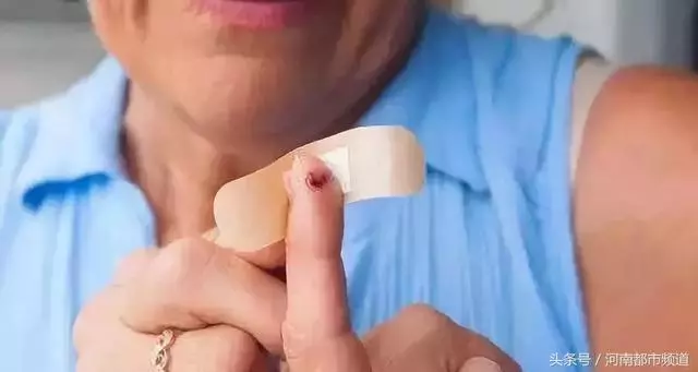 「提醒」什麼傷口可以用創可貼?這五種情況還真不適合