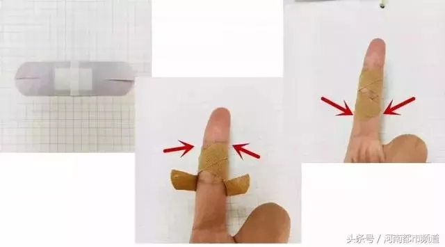 「提醒」什麼傷口可以用創可貼?這五種情況還真不適合
