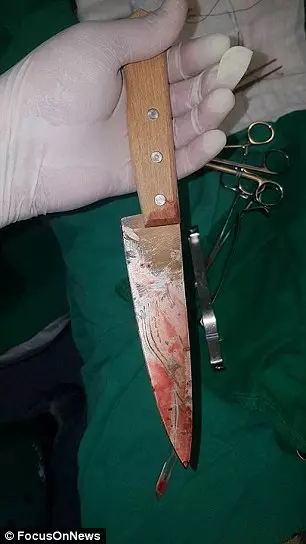 男子「突然被插一刀」狂噴血,轉身「淡定插著刀聊天」送醫後醫生狂讚嘆:冷靜救了你一命!