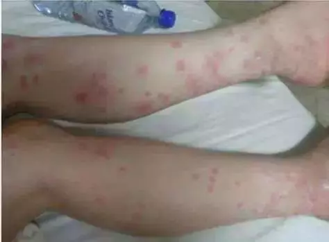 教你一招,洗枕頭時加點這個,幾百萬只小蟲統統不見了