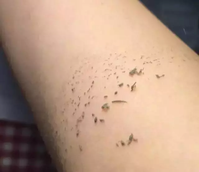 洗澡時搓出來的泥到底是什麼?
