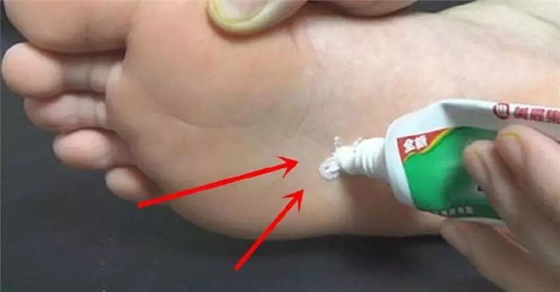 睡前牙膏抹在腳底下,很多人都不知道為什麼,看完你會感謝我的!