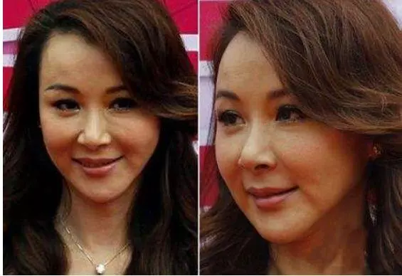 50歲的蕭薔撞上50歲的邱淑貞,整容臉和自然老去的差距立現