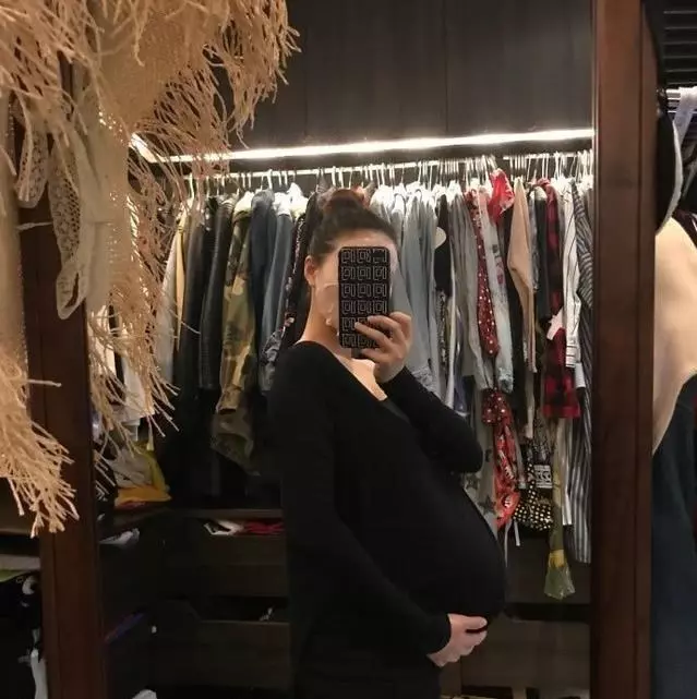歐弟妻子二胎肚子巨大,手都托不住,自稱:遍布驚人血管和黑色素!