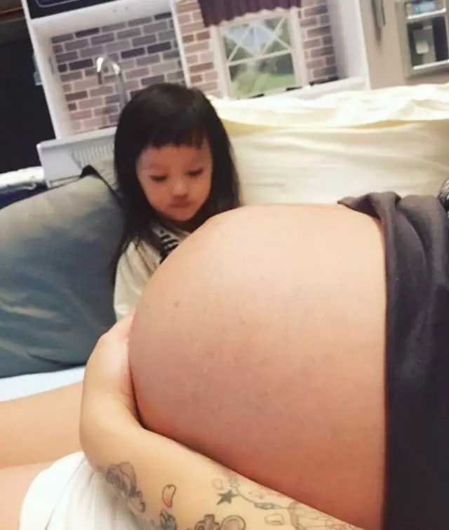 歐弟妻子二胎肚子巨大,手都托不住,自稱:遍布驚人血管和黑色素!