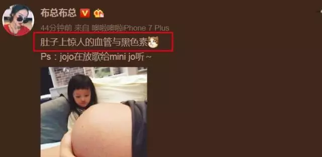 歐弟妻子二胎肚子巨大,手都托不住,自稱:遍布驚人血管和黑色素!