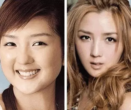 女星整容算什麼?劉愷威面癱程度再升級,而他直接90萬「換臉」!