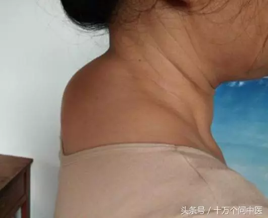 日常生活中經常做這三個動作,讓你和「圓肩駝背」說「拜拜」~