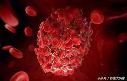 高溫天氣!血液易粘稠,出現4個信號,需警惕血栓,5件事要少做 - 讀讀