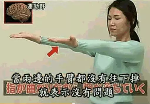 日本專家講解如何判斷【腦梗塞】前兆,記住一個就可以避免 - 讀讀