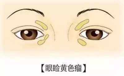 注意!「心臟」好不好,看臉就知道!有這10種「長相」的人危險了,特別是第三種千萬小心! - 讀讀