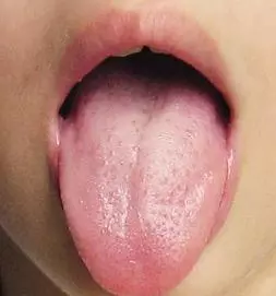 體內風寒濕氣如何驅除?每天拍打這3個部位,排出濕氣一身輕鬆!
