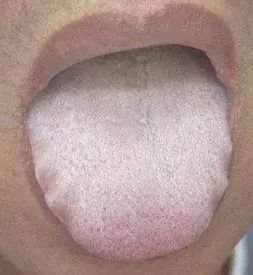 體內風寒濕氣如何驅除?每天拍打這3個部位,排出濕氣一身輕鬆!
