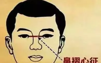 心臟好不好,看三個地方就知道!