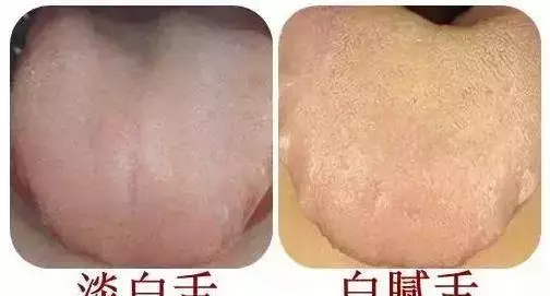 心臟好不好,看三個地方就知道!