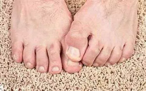 「腎」不好腳知道,如果腳上沒有這4個表現,恭喜!你的腎很健康