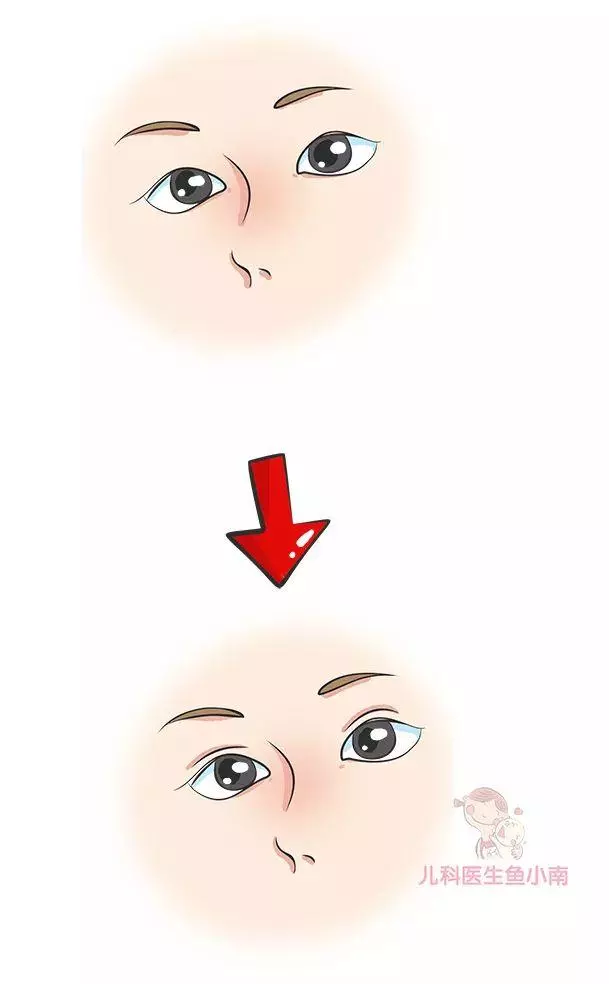 寶寶現在小眼睛,以後會變大嗎?醫生:超過這個年齡,不會再大了