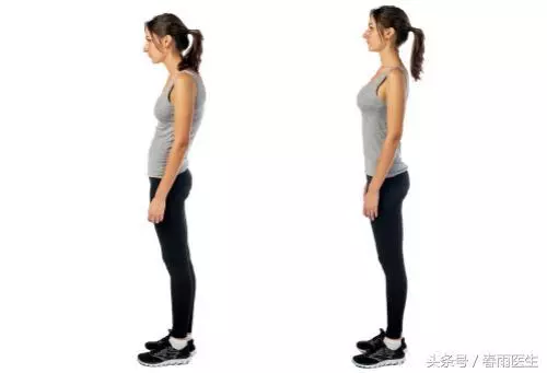 總是覺得「脖子緊」?朋友,請小心上交叉綜合症
