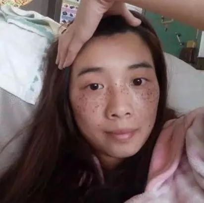 生薑加它色斑不見,40歲大姐重返20歲好皮膚,方法很簡單,在家就能做