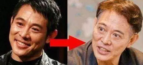 甲狀腺腫大不用擔心,一個千年流傳下來的中藥方,疏肝解鬱很有效,肝臟好、甲亢消!