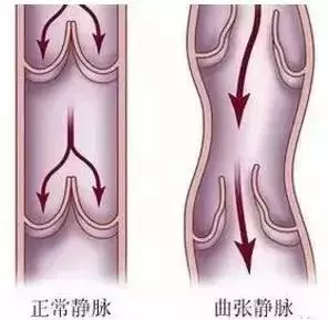 拉開身上「筋結」,體內百病去,專家獨門拉筋法,8~80歲都適用