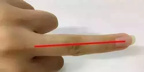 刮幾根手指,一次搞定十幾種病,太實用了!