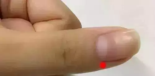 刮幾根手指,一次搞定十幾種病,太實用了!