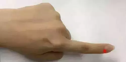 刮幾根手指,一次搞定十幾種病,太實用了!
